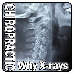 chiropractic x-rays